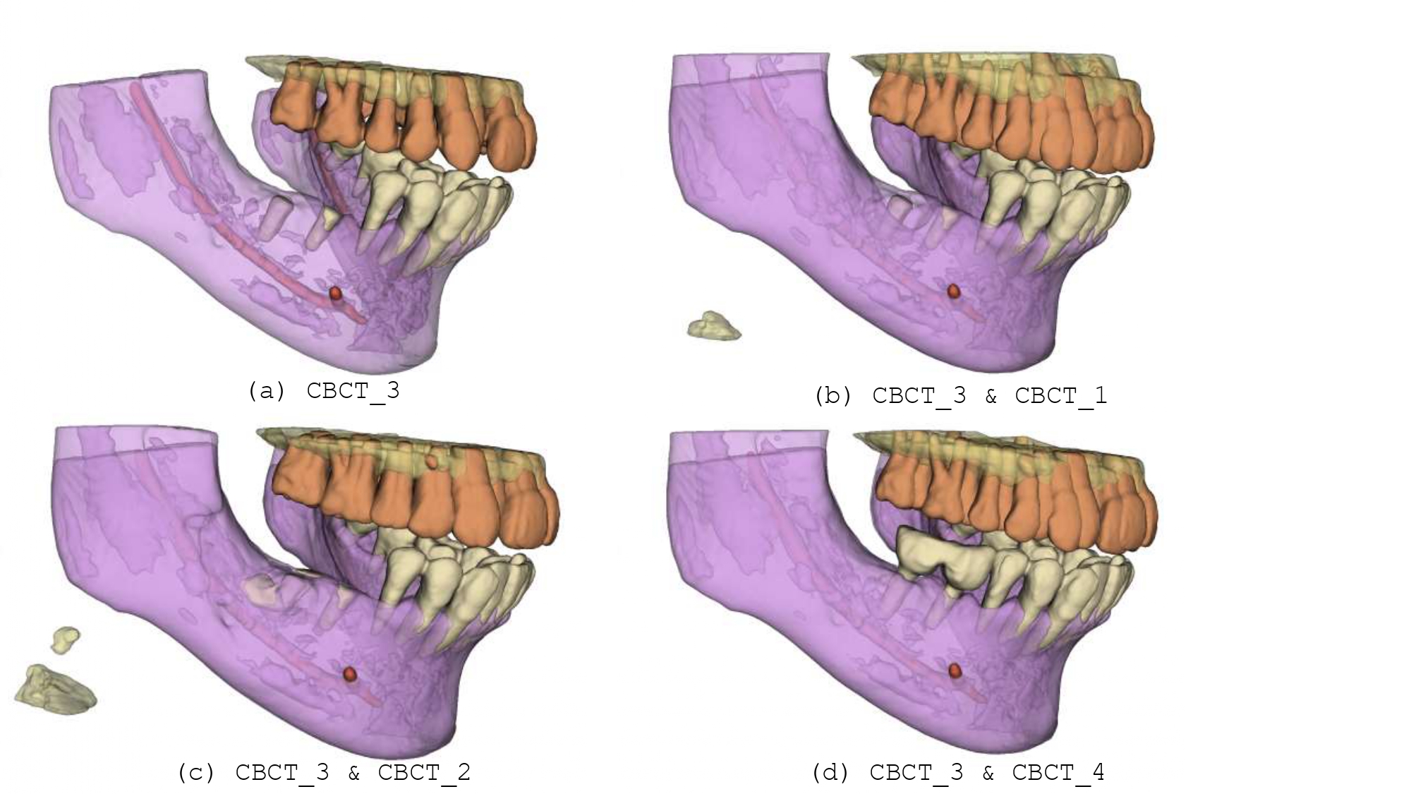 CBCT Registration Teaser